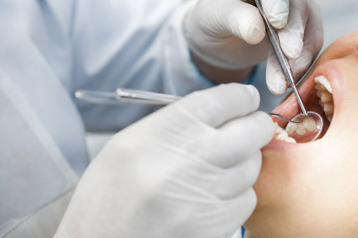 Dentist performing indirect pulp capping technique on a deep carious lesion under magnification