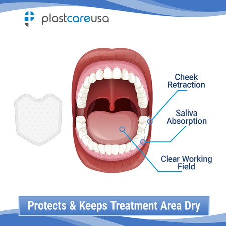 200 Small Dental Dry Angles - Saliva Absorbent Cotton Roll Substitute - back view | DoctorSupplies.com