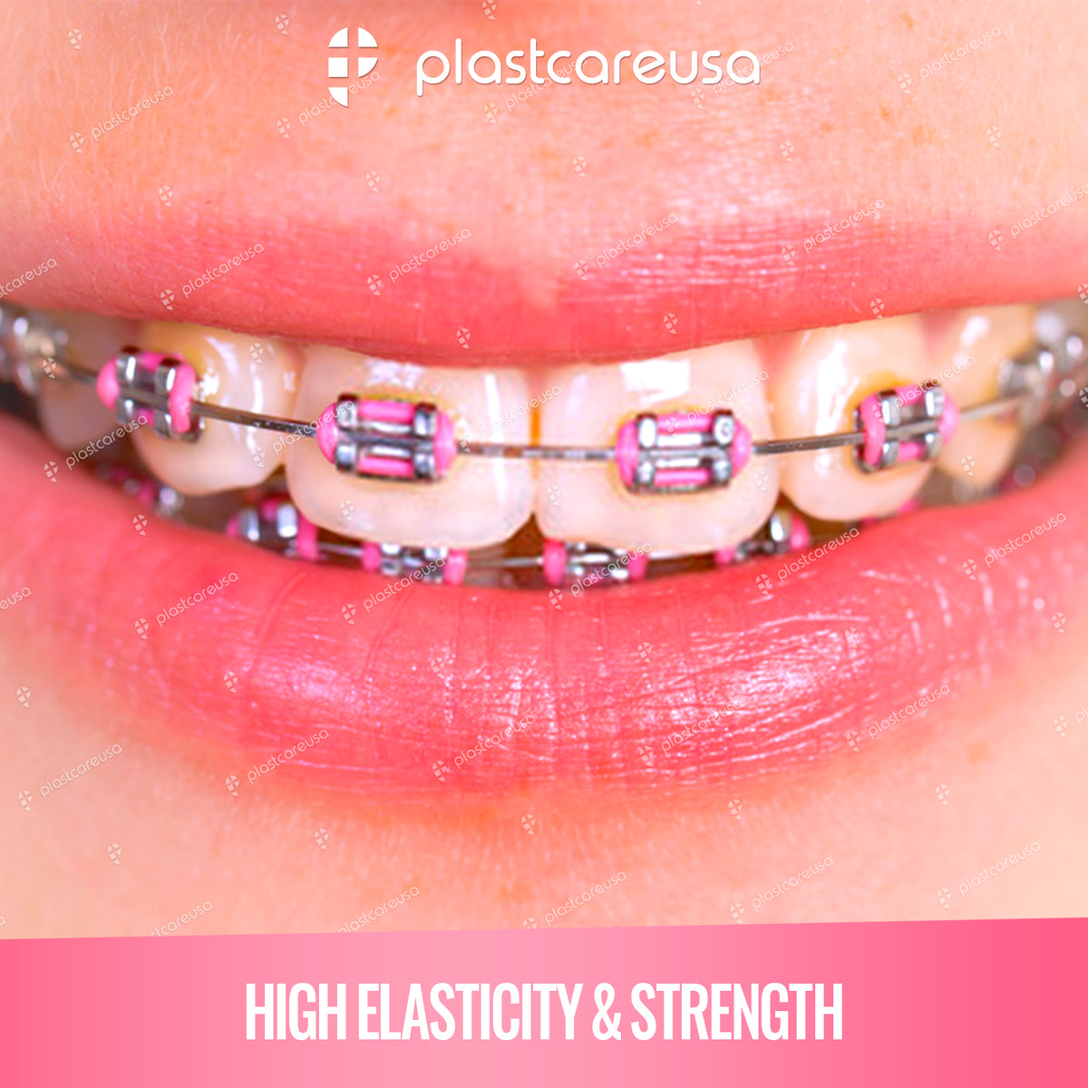 Dental Ligature Ties - 1040 Assorted Orthodontic Elastic Bands - side view | DoctorSupplies.com