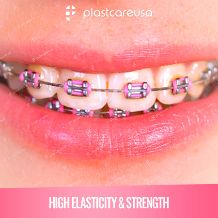 Dental Ligature Ties - 1040 Assorted Orthodontic Elastic Bands - side view | DoctorSupplies.com