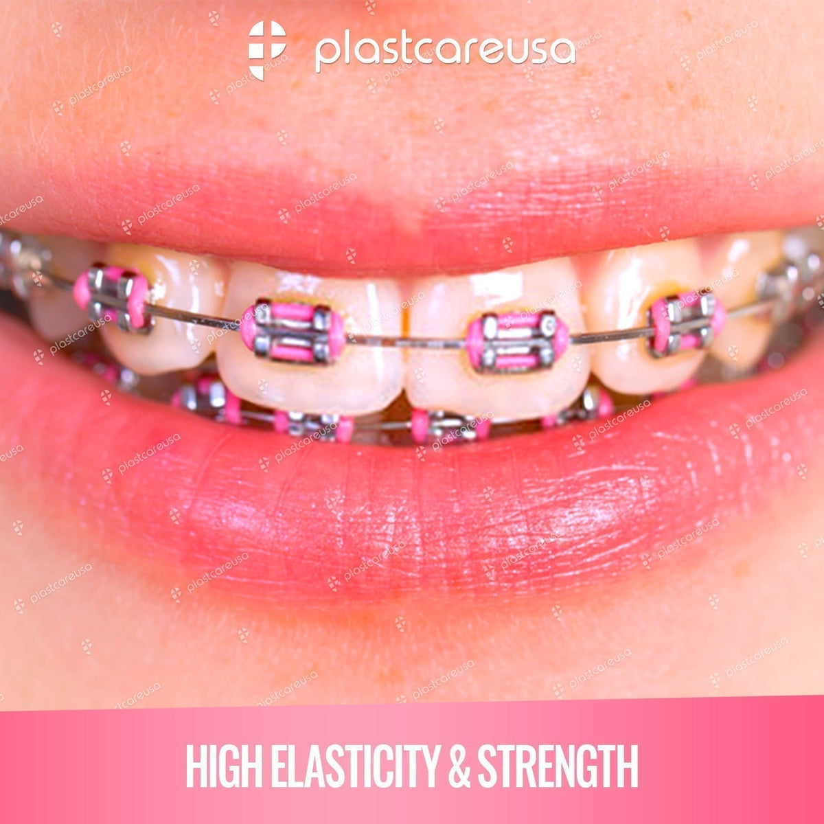 Pink Orthodontic Elastic Ligature Ties 1040/Bag | Latex-Free - back view | DoctorSupplies.com