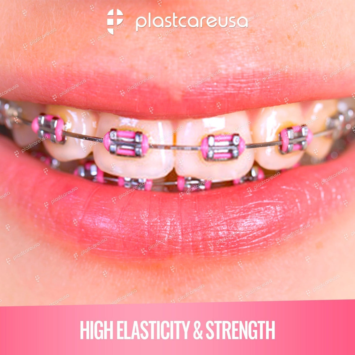 Clear Dental Ligature Ties 1040ct | Orthodontic Elastic Bands - back view | DoctorSupplies.com